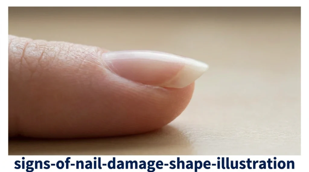 signs of nail damage to watch for - proper gel soak off removal